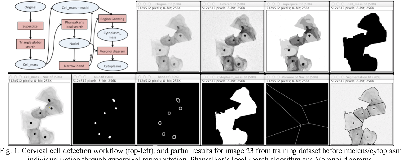 Segmentation Of Subcellular Compartments Combining Superpixel Representation With Voronoi Diagrams